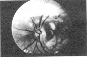 p159fundus2