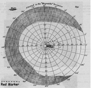 p160perimetry1